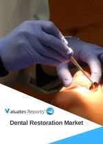 Dental Restoration Market