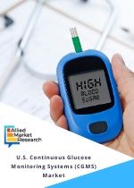 us continuous glucose monitoring systems market