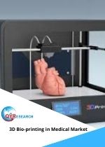 Global 3D Bioprinting in Medical Market Report
