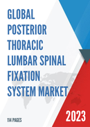 Global Posterior Thoracic Lumbar Spinal Fixation System Market Research Report 2022