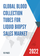 Global Blood Collection Tubes for Liquid Biopsy Sales Market Report 2022