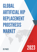 Global Artificial Hip Replacement Prosthesis Market Research Report 2023