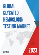 Global Glycated Hemoglobin Testing Market Size Status and Forecast 2021 2027