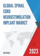 Global Spinal Cord Neurostimulation Implant Market Research Report 2022