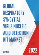Global Respiratory Syncytial Virus Nucleic Acid Detection Kit Market Research Report 2022