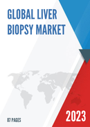 Global Liver Biopsy Market Size Status and Forecast 2021 2027