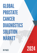 Global Prostate Cancer Diagnostics Solution Market Research Report 2022